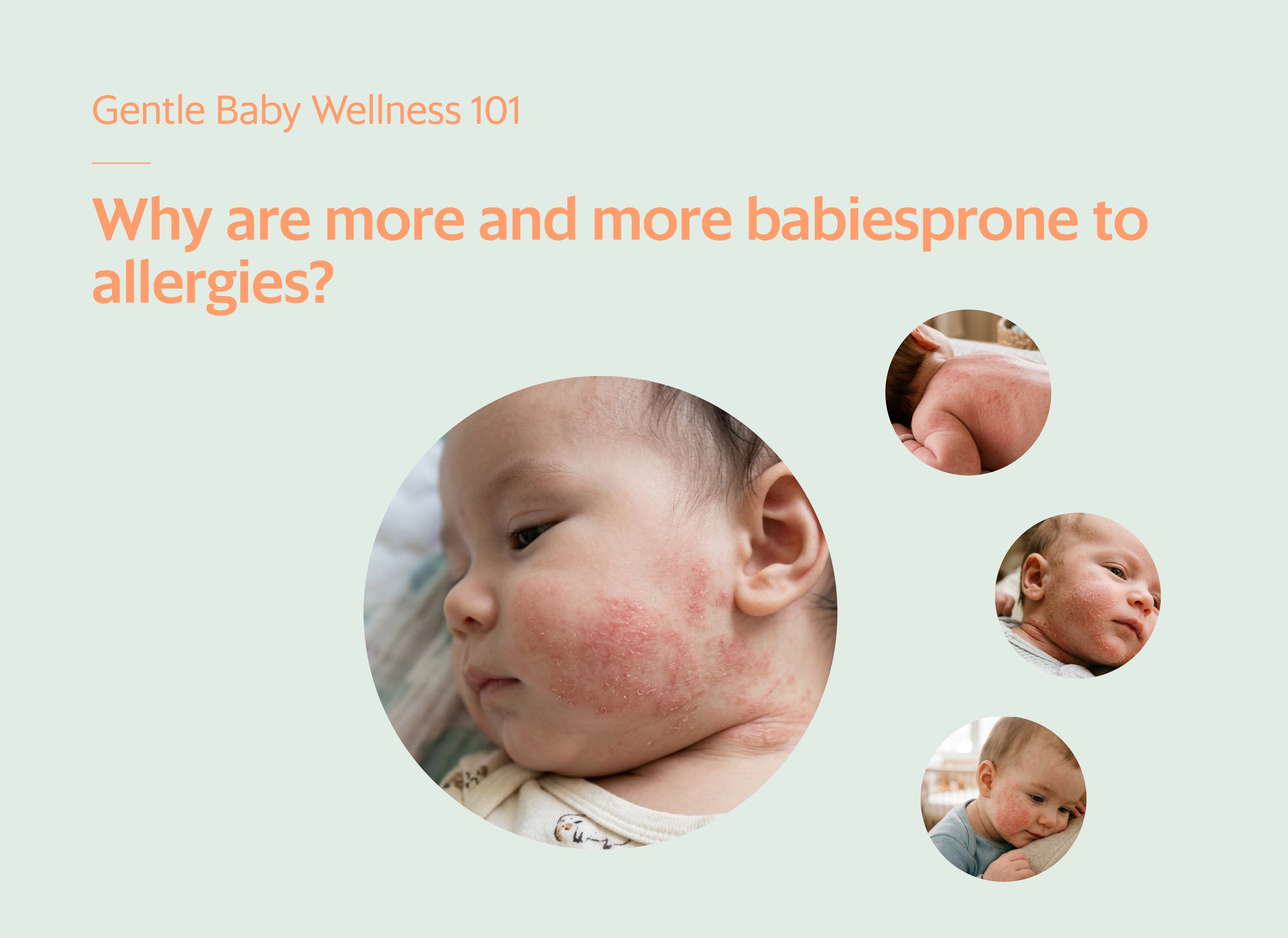 Gentle Baby Wellness 101: Why are More and More Babies Prone to Allergies?